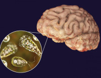 9-летний мальчик, заразившийся амебой Naegleria fowleri в Кинерете, умер в больнице