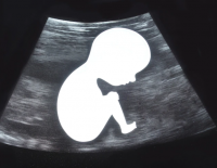 Беспрецедентный случай в медицинской и юридической практике Израиля с перепутанными эмбрионами