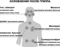 Эпидемия гриппа в Израиле на высоком старте: от осложнений скончалась 10-летняя девочка