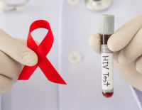 Минздрав: В Израиле заболеваемость ВИЧ снизилась на 22%