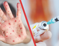 С начала вспышки в Израиле было зарегистрировано 618 случаев кори